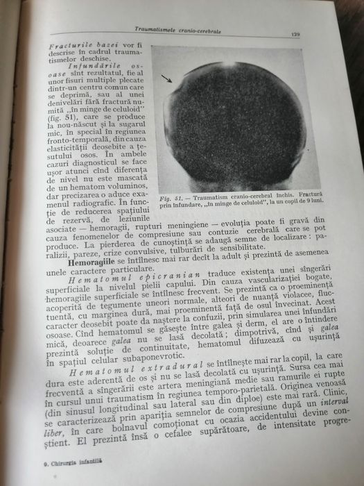 Chirurgie infantila de urgenta