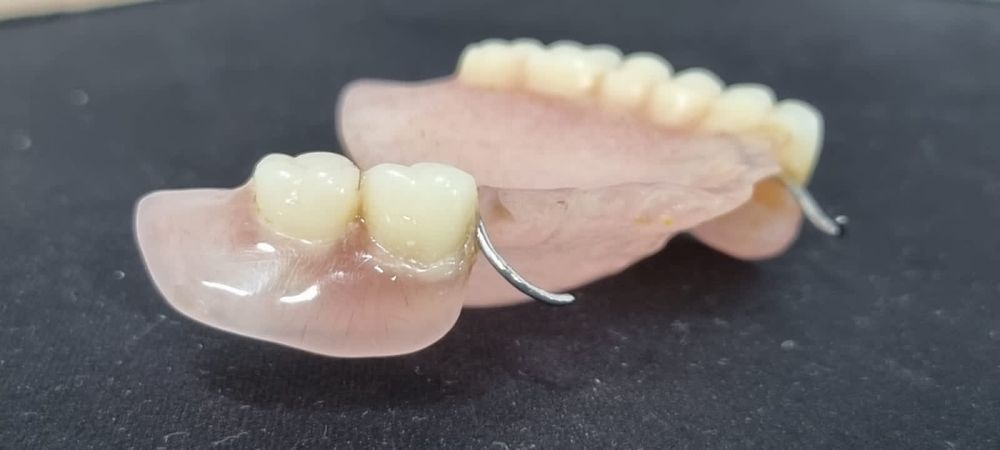 Починка протезов