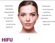 Aparat HIFU - rejuvenare non-invaziva