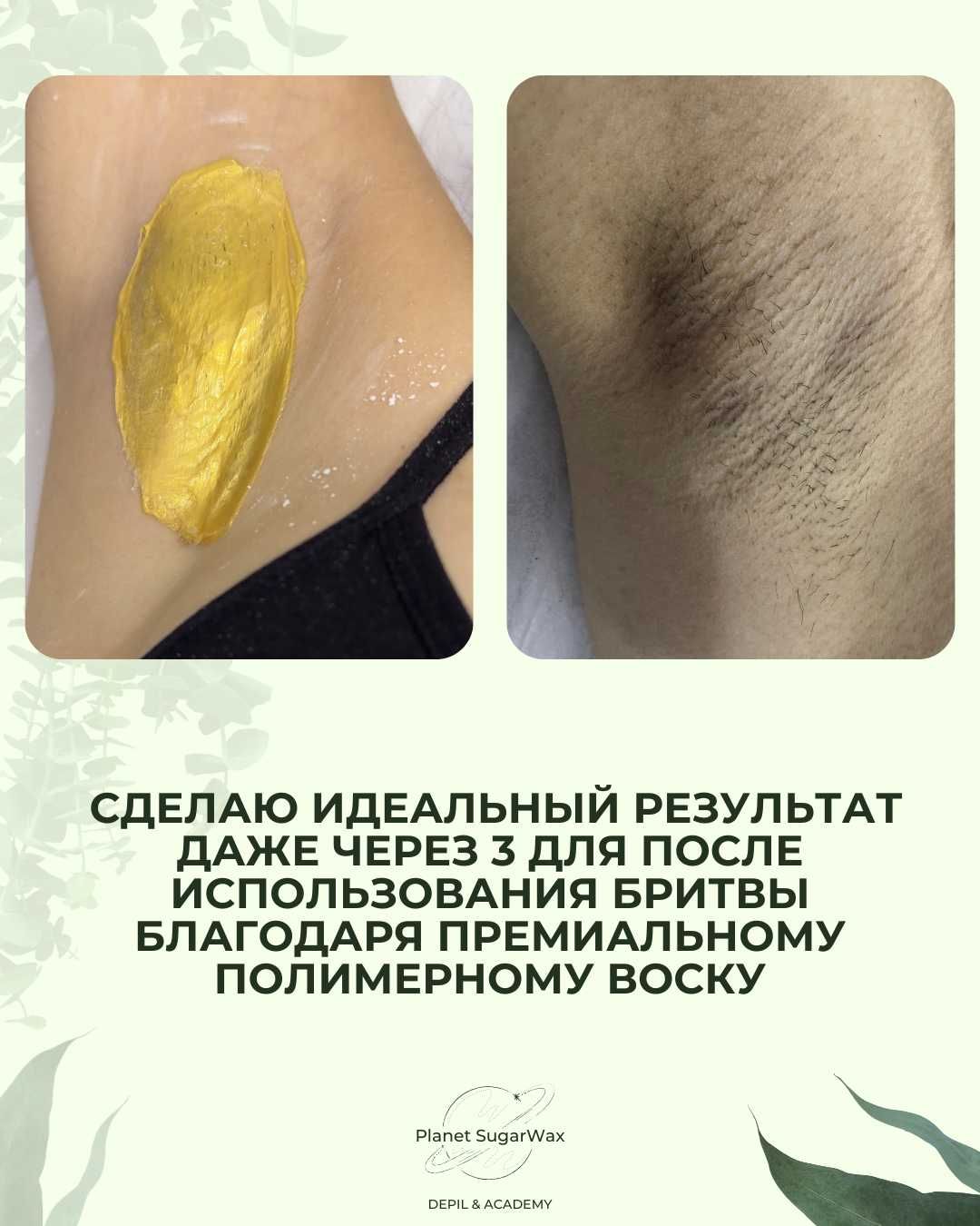 депиляция без боли и стресса полимерный воск | шугаринг | эпиляция