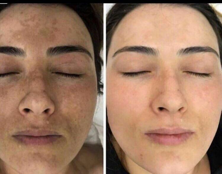 100% tabiy collagen ulitkalar sotuvda bor