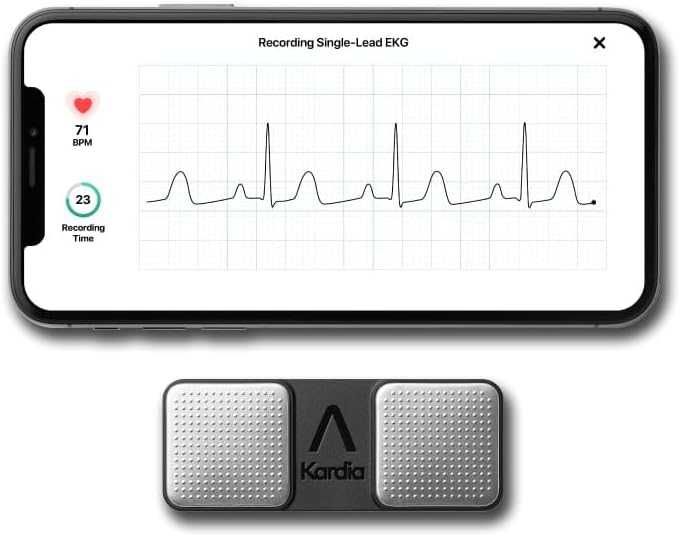 KardiaMobile ЕКГ монитор от AliveCore by OMRON