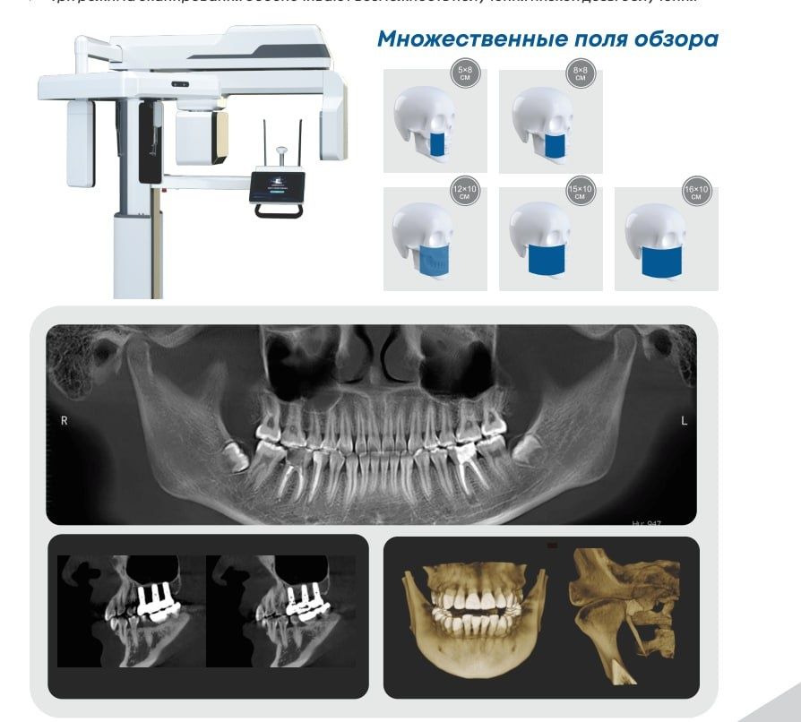 3D-рентген. Дентальный 3Д  Стоматологический рентген. Панорамный фото