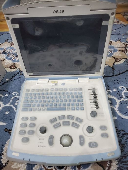 Ultra tovush tekshiruvi (uzi)