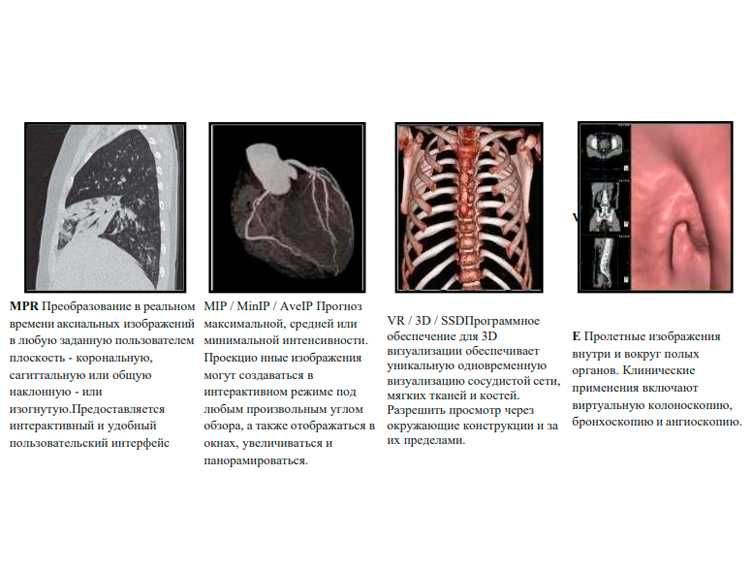 Компьютерный томограф NeuViz 64