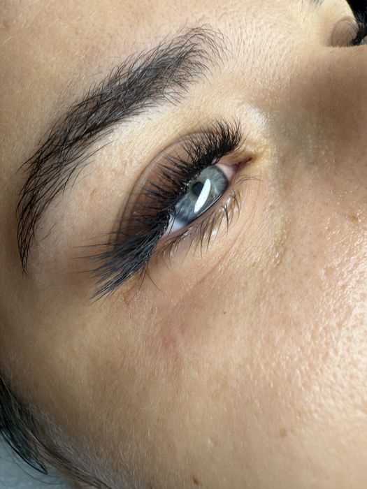 Extensii de gene Lujerului