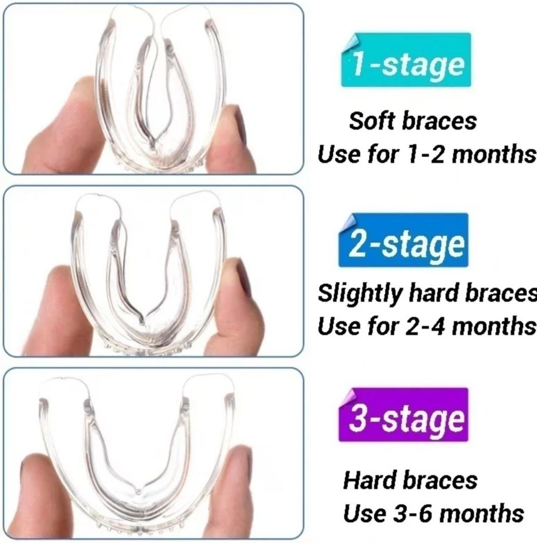 Промо-Ортодонтски коректор,шини,алайнер на зъби брекети зъбен фиксатор