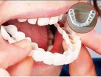 Fatete dentare universale