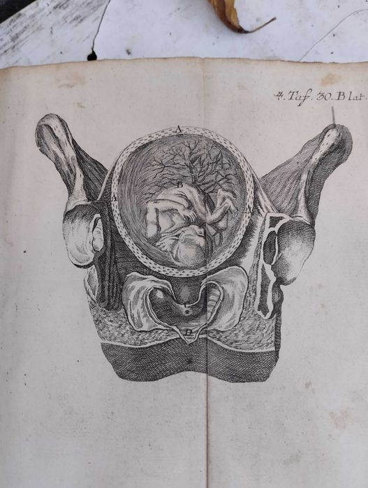 Carte veche de medicina (obstretica)