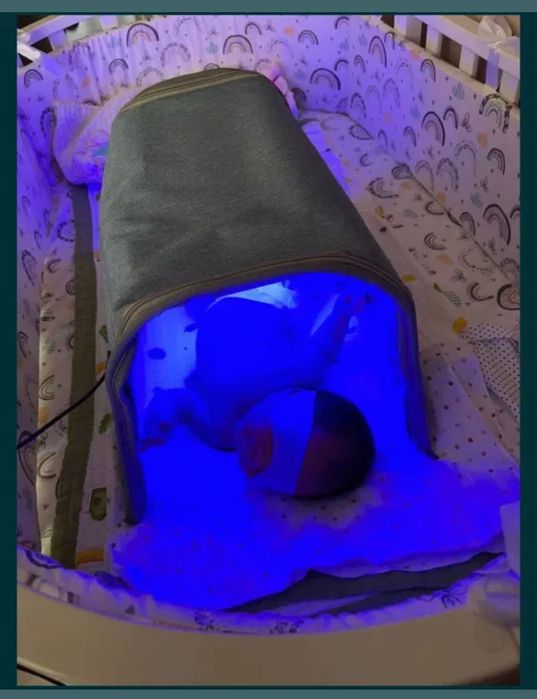 Лампы от желтухи