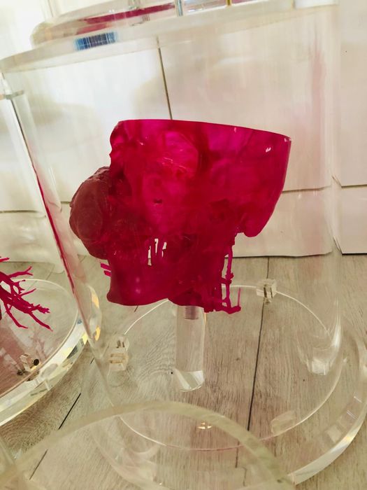Super aet medical 3D organe craniu in cutii acryl plexiglasss