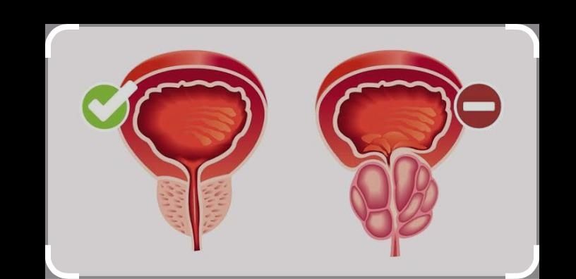 Ерлер денсаулыгы массаждар женилдикпен
