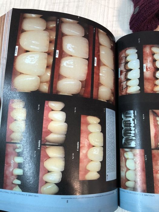 Esthetic Rehabilitation in Fixed Prosthodontics, Volume 1 & 2 FRADEANI