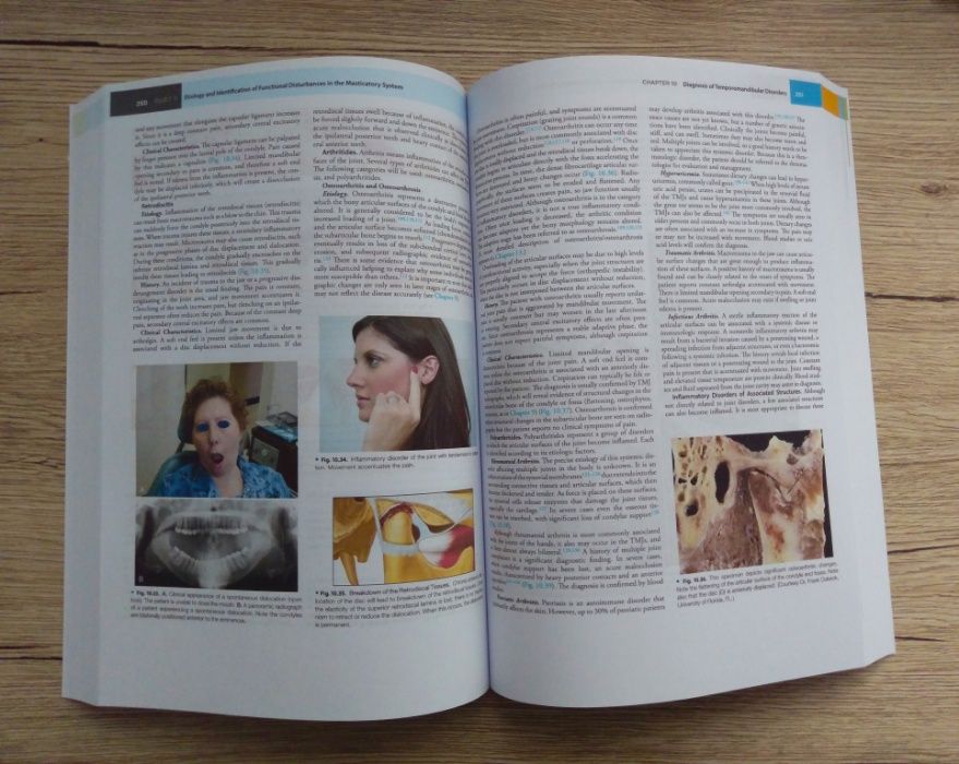 Management of Temporomandibular Disorders and Occlusion J.Okeson Ed.8