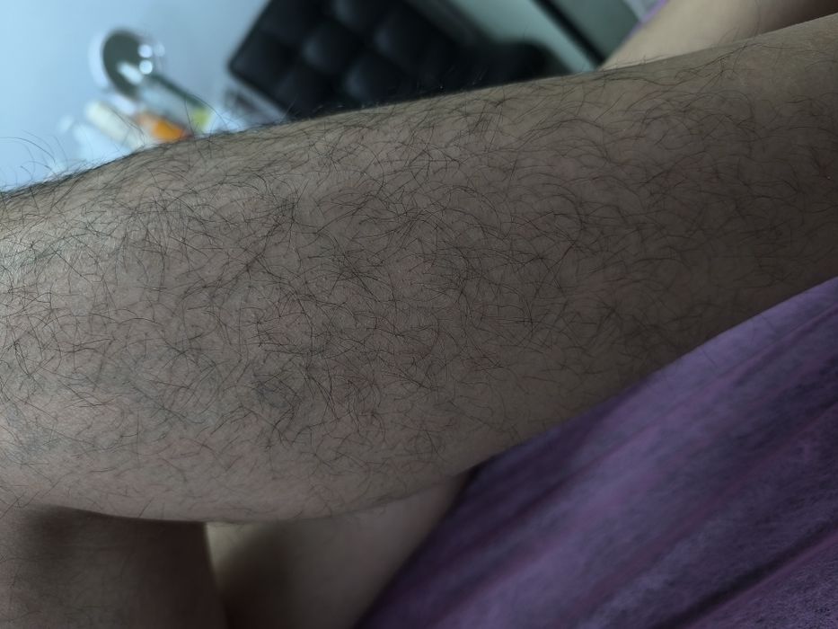 Акция Депиляция Шугаринг