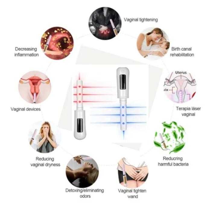 360° Гинекологично Неинвазивна Лазерна Терапия за Влагалищно Затягане