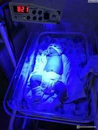 Eng havfsiz va bezarar fotolampa va bilirubin olchash 50000