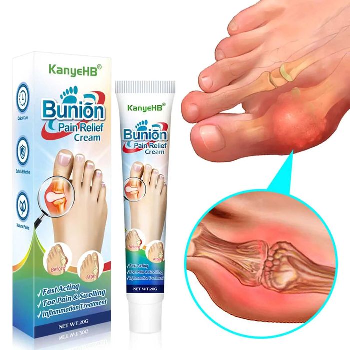 2 buc. Cremă inflamatii articulatii degete, monturi, guta, reparatorie