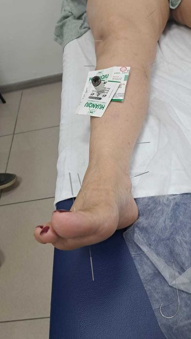 Массаж, иглотерапия,магнитотерапия