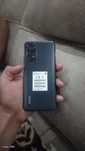 Xiaomi Redmi not 11