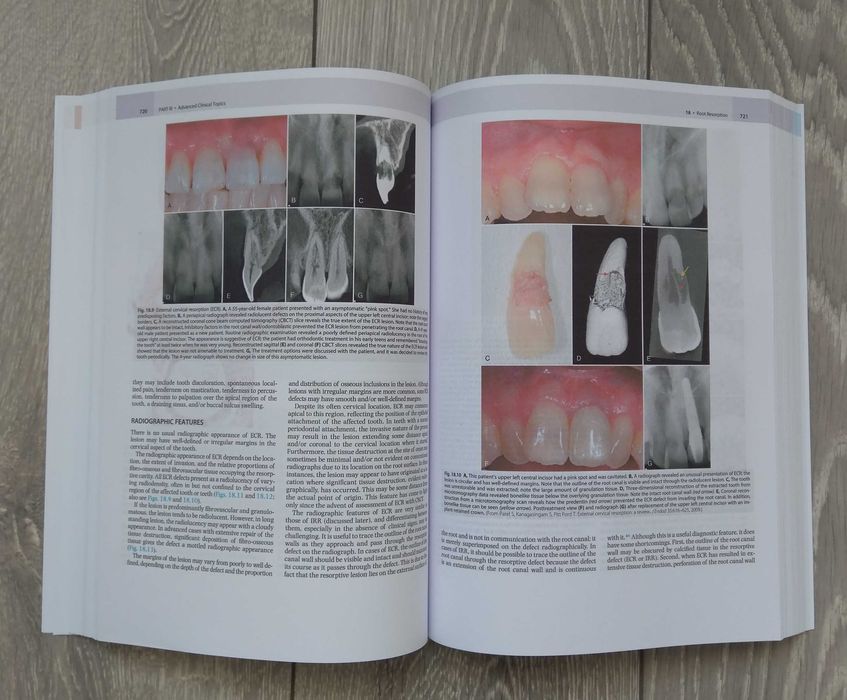 Cohen's Pathways of the Pulp: 12th Edition Engleza