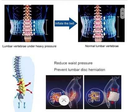 Надувной поясной декомпрессионный пояс.