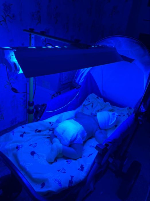 Фотолампа аренда, фотолампа уральск, лампа от желтушки 24/7, Билитест