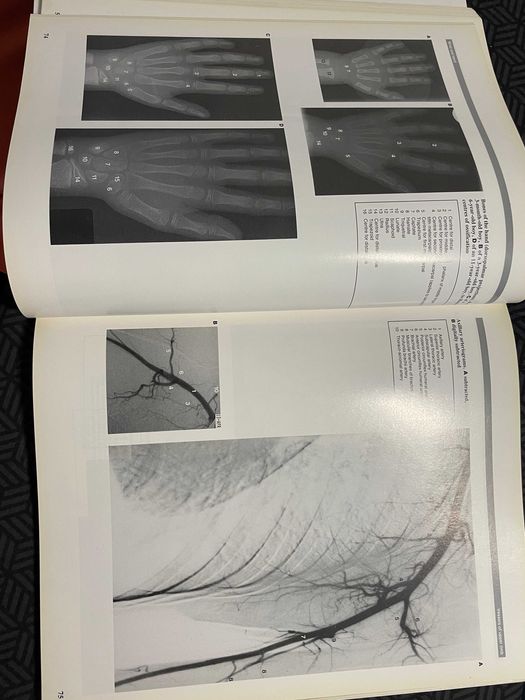Atlas imagistic de anatomie umana Wolfe medicina rezidentiat impecabil