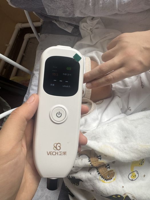 Fototerapiya/ fotolampa kichkinasi va kottasi