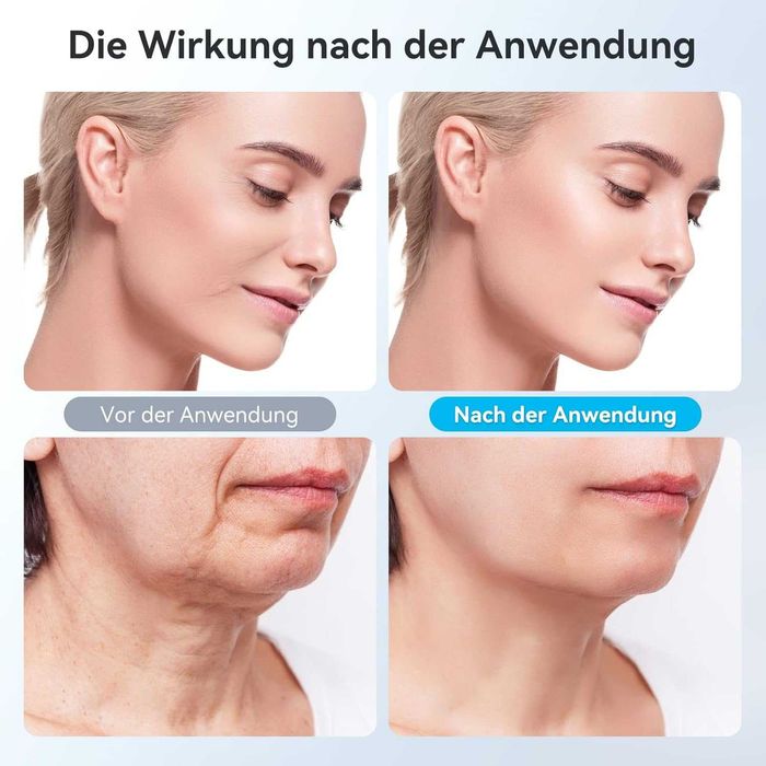 Dispozitiv Lifting Facial