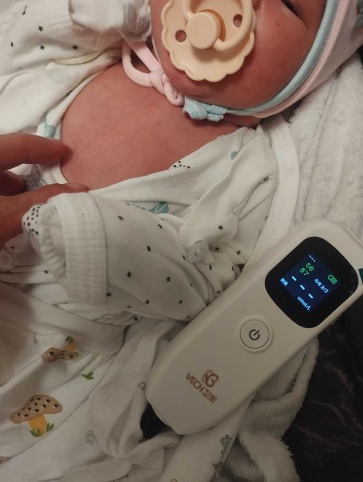 Билрубин олчаб бериш. Служба измерения билирубина