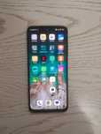 Redmi not 11 pashte yangi