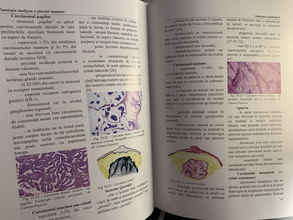 Tratat oncologie Patologia maligna a glandei mamare Prof Bădulescu