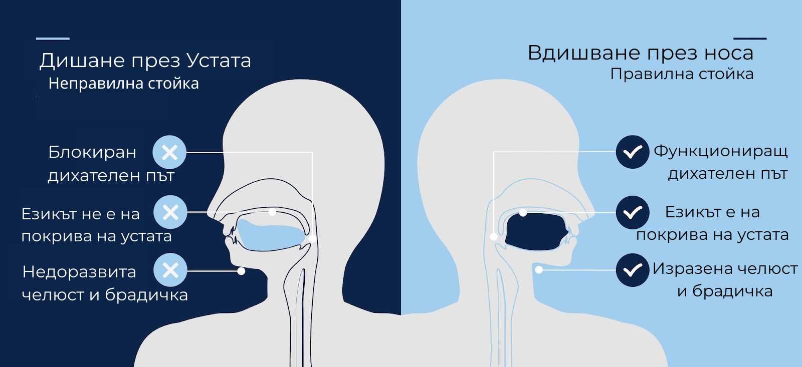 Лепенки за нос за свободно дишане (Nose breathing strips) Oxygen Rush!