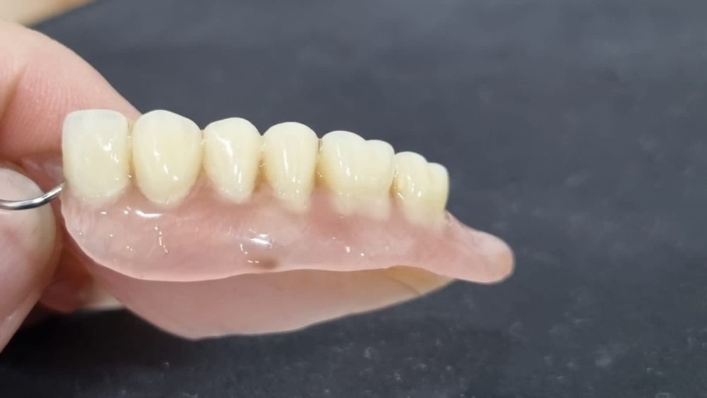 Починка протезов