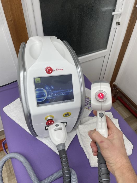 Laser stergere tatuaje