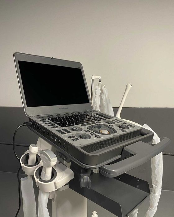 Высокотехнологичный портативный УЗИ аппарат SonoScape X3