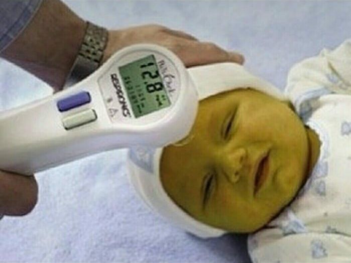 Лампа от желтушки, Билитест Каскелен