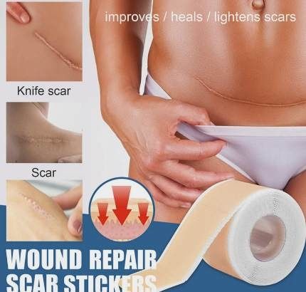 Силиконовый пластырь для лечения шрамов и рубцов. 4 см на 50 см