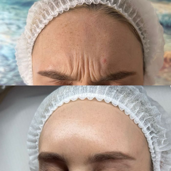 Услуги косметолога эстетиста! Все виды процедур