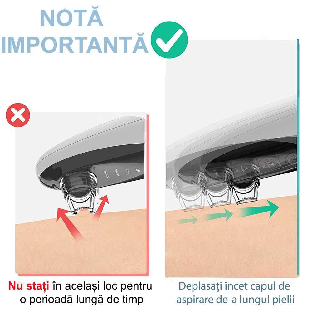 Aparat electric,portabil,curatare ten,scos cosuri, acnee, puncte negre