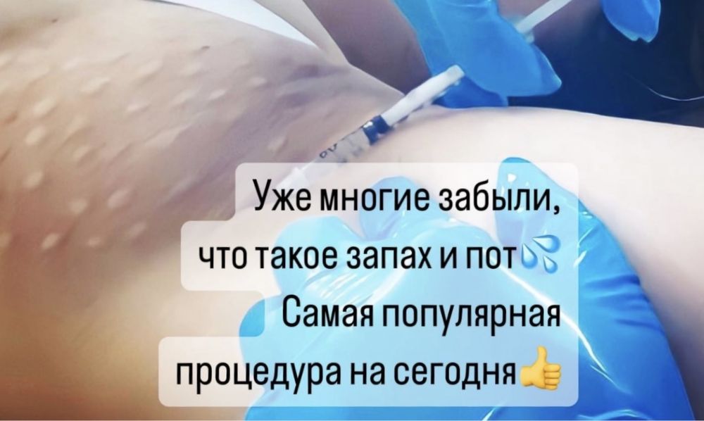 Гипергидроз,увеличение губ,боток,чистка,пилинг,плазма,био,жировик