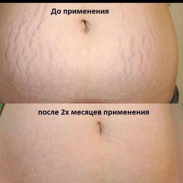 100% tabiy collagen ulitkalar sotuvda bor