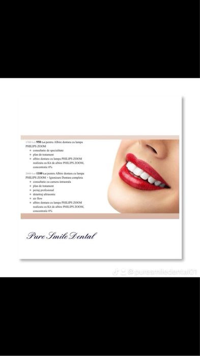 Voucher albire dentara