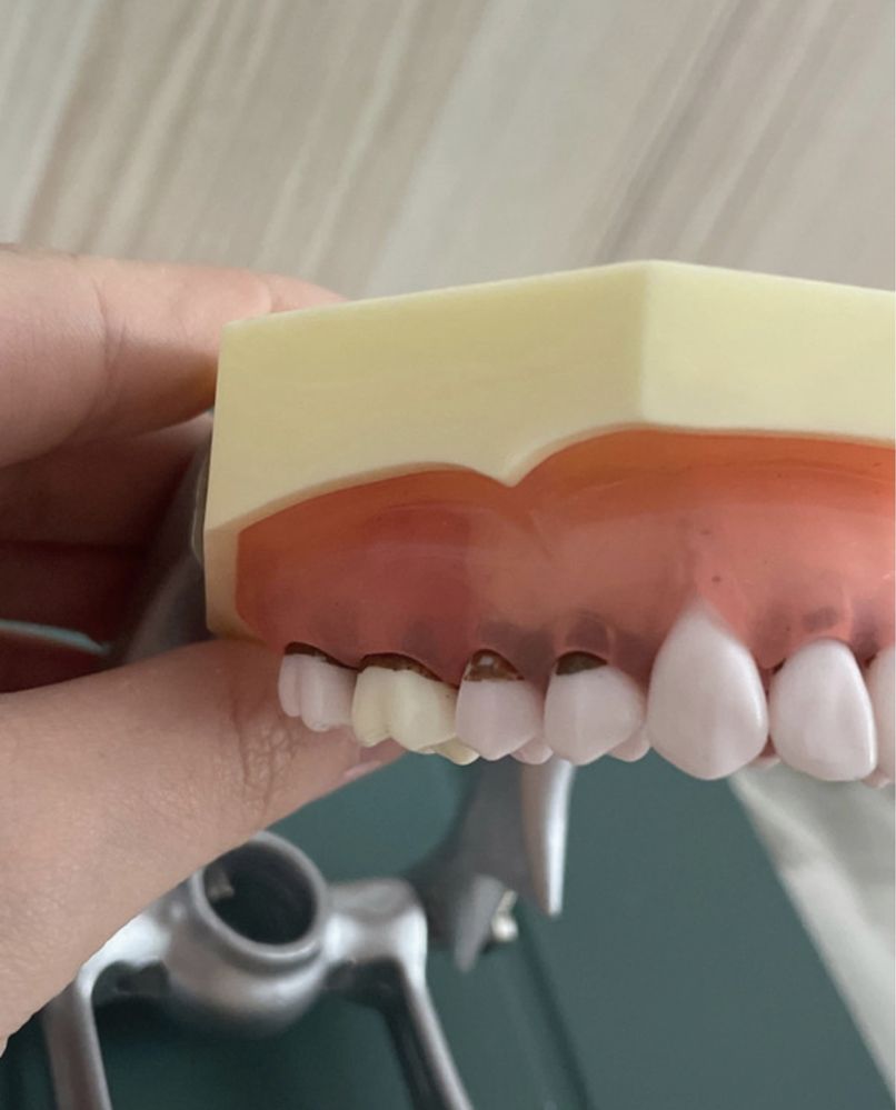 Model boală parodontală cu dinţi detaşabili cu şurub - 4023