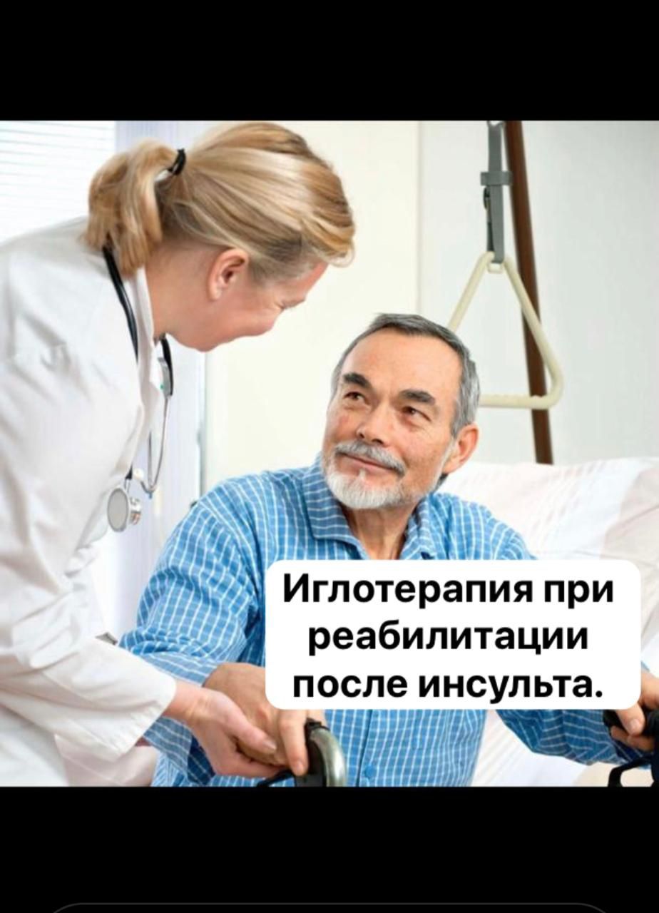 Иглорефлексотерапия при реабилитации пациентов после Инсульта.