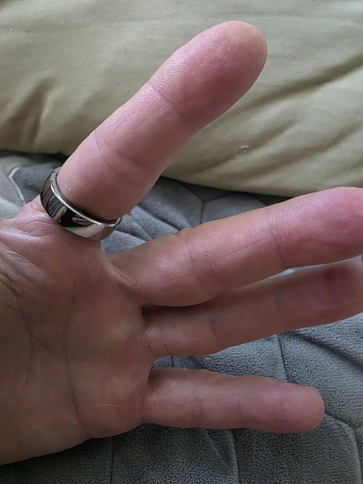 Smart ring RING CONN GEN 2  mărimea 11