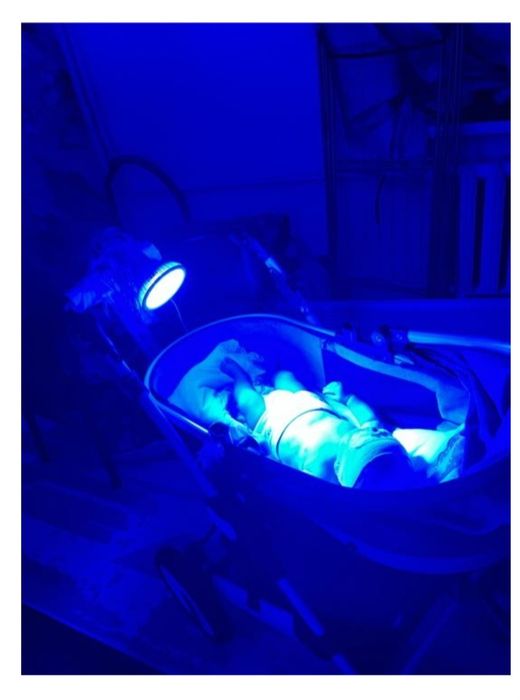 Сдам в аренду фотолампу светодиодную (от желтушки для новорожденных)
К