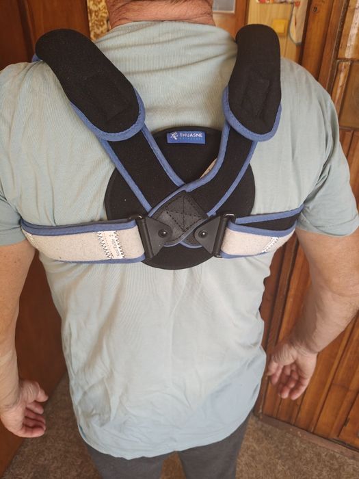 Клавикуларен бандаж при счупена ключица (Ортеза)