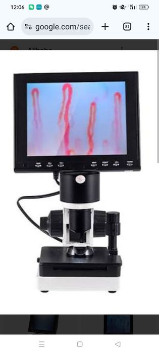 Капиляроскоп новый